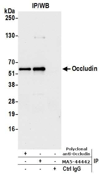 Occludin Antibody in Immunoprecipitation (IP)