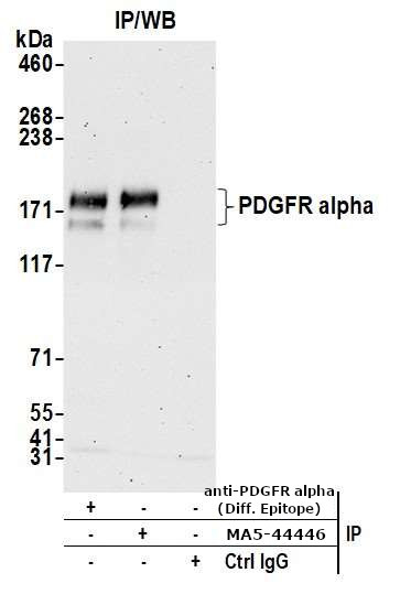 CD140a (PDGFRA) Antibody in Immunoprecipitation (IP)