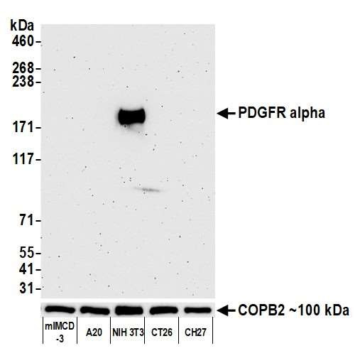 CD140a (PDGFRA) Antibody in Western Blot (WB)