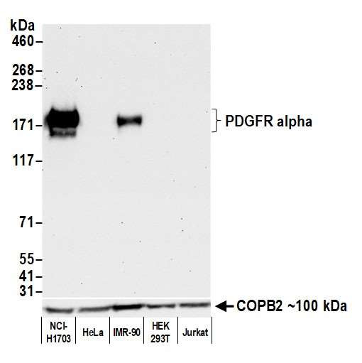 CD140a (PDGFRA) Antibody in Western Blot (WB)