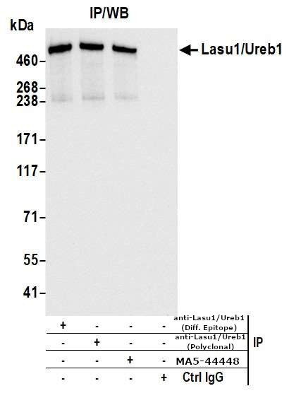 HUWE1 Antibody in Immunoprecipitation (IP)