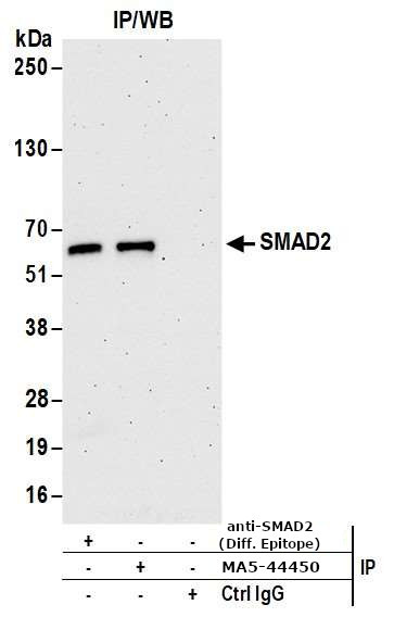 SMAD2 Antibody in Immunoprecipitation (IP)