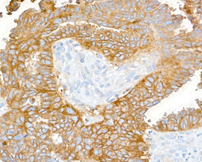 CD47 Antibody in Immunohistochemistry (Paraffin) (IHC (P))