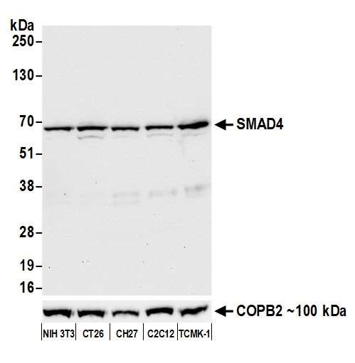 SMAD4 Antibody in Western Blot (WB)