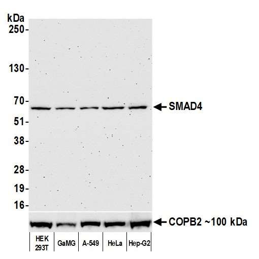 SMAD4 Antibody in Western Blot (WB)