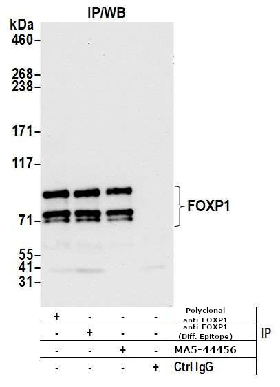 FOXP1 Antibody in Immunoprecipitation (IP)