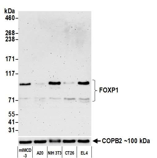 FOXP1 Antibody in Western Blot (WB)