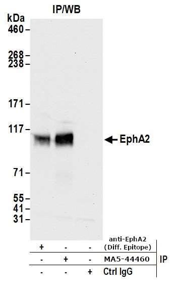 EphA2 Antibody in Immunoprecipitation (IP)