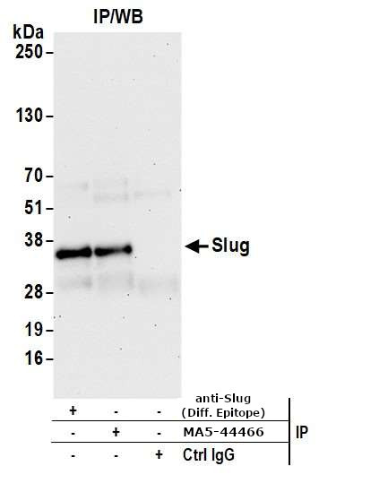 SLUG Antibody in Immunoprecipitation (IP)