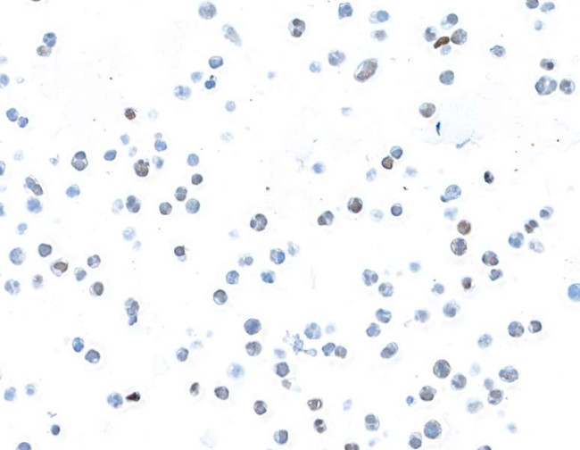 BCL6 Antibody in Immunocytochemistry (ICC/IF)