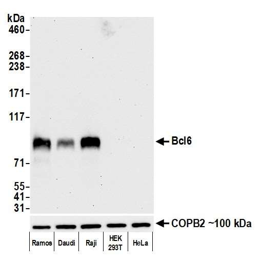 BCL6 Antibody in Western Blot (WB)