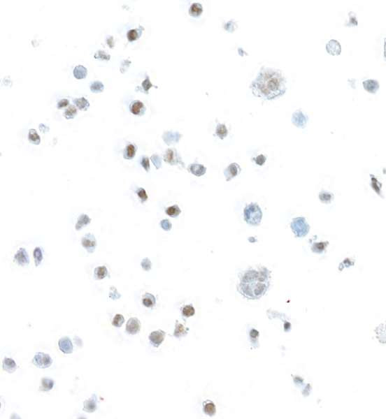 STAT5 beta Antibody in Immunocytochemistry (ICC/IF)