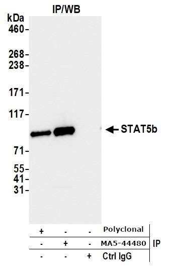 STAT5 beta Antibody in Immunoprecipitation (IP)