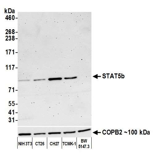 STAT5 beta Antibody in Western Blot (WB)