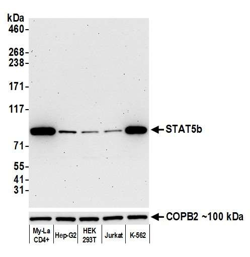 STAT5 beta Antibody in Western Blot (WB)