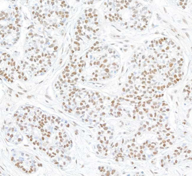 STAT6 Antibody in Immunohistochemistry (Paraffin) (IHC (P))