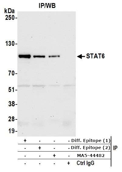 STAT6 Antibody in Immunoprecipitation (IP)