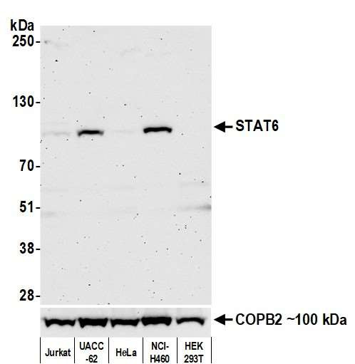 STAT6 Antibody in Western Blot (WB)