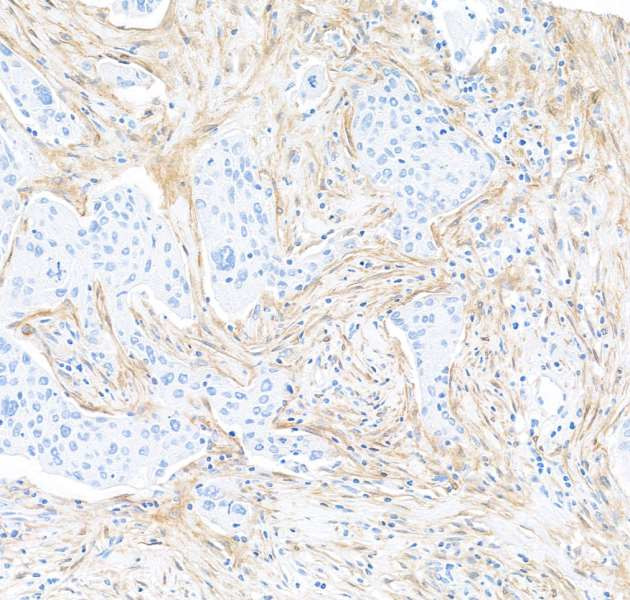 FAP Antibody in Immunohistochemistry (Paraffin) (IHC (P))