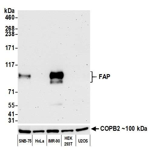 FAP Antibody in Western Blot (WB)