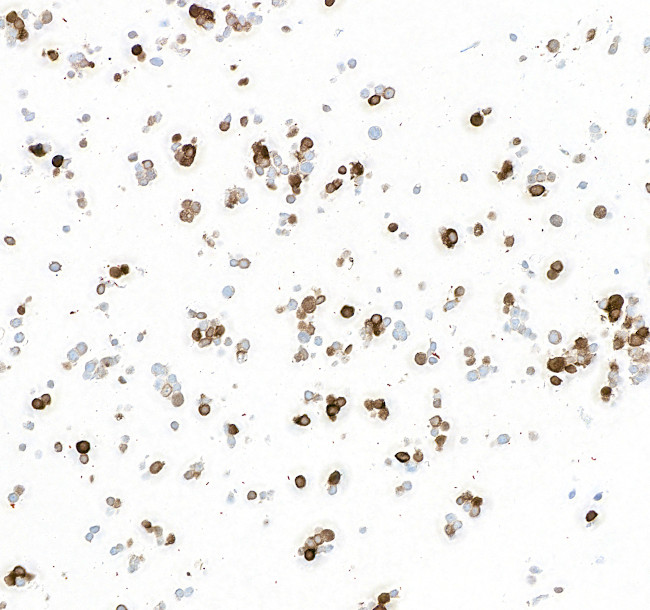 Tyrosine Hydroxylase Antibody in Immunocytochemistry (ICC/IF)