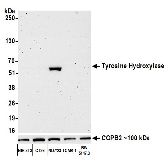 Tyrosine Hydroxylase Antibody in Western Blot (WB)