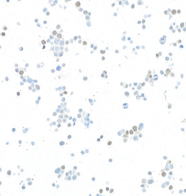 TWIST1 Antibody in Immunocytochemistry (ICC/IF)