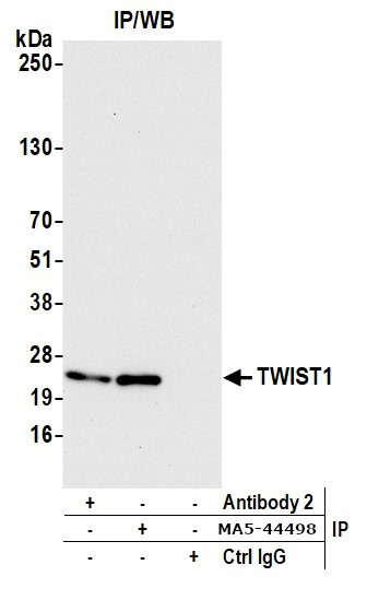TWIST1 Antibody in Immunoprecipitation (IP)