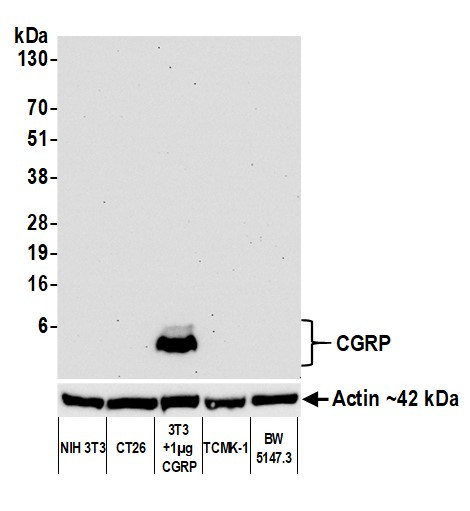 CGRP Antibody in Western Blot (WB)