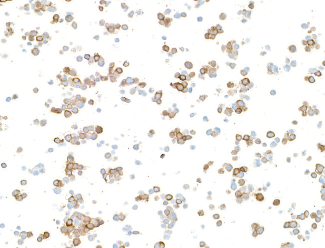 Doublecortin Antibody in Immunocytochemistry (ICC/IF)