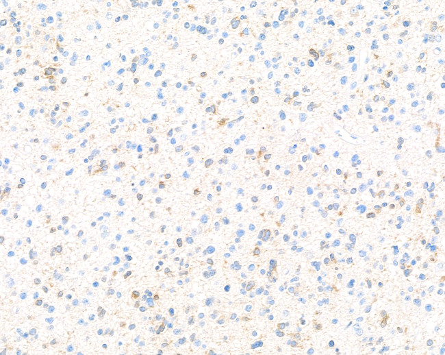 Doublecortin Antibody in Immunohistochemistry (Paraffin) (IHC (P))