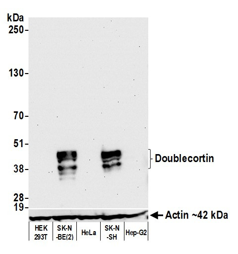 Doublecortin Antibody in Western Blot (WB)