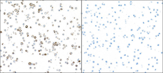 iNOS Antibody in Immunocytochemistry (ICC/IF)