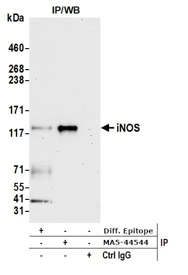 iNOS Antibody in Immunoprecipitation (IP)