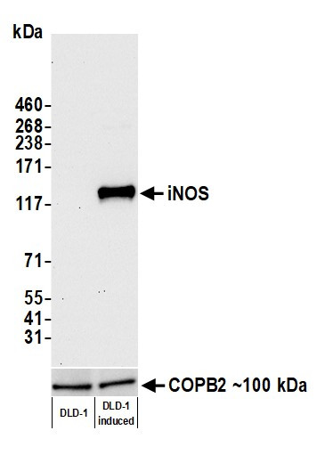 iNOS Antibody in Western Blot (WB)