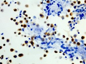 B-Raf (V600E) Antibody in Western Blot (WB)