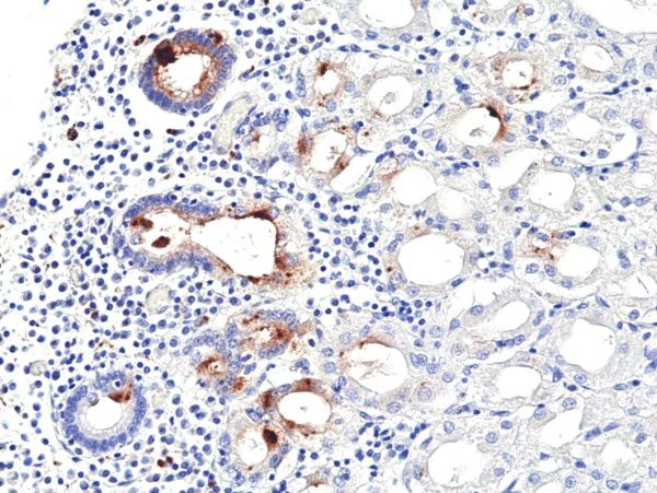 Helicobacter pylori Antibody in Immunohistochemistry (Paraffin) (IHC (P))