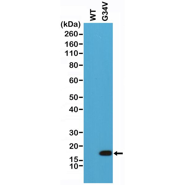 H3.3 G34V oncohistone mutant Antibody in Western Blot (WB)