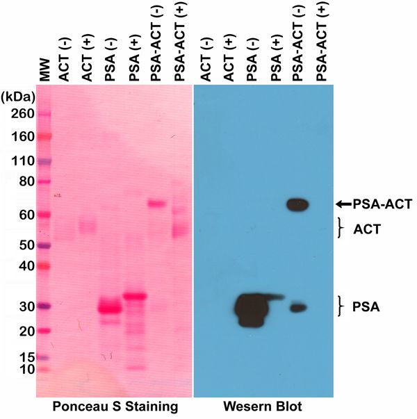 PSA Antibody in Western Blot (WB)