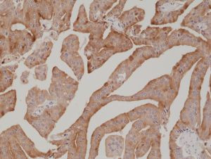 PSA Antibody in Immunohistochemistry (Paraffin) (IHC (P))