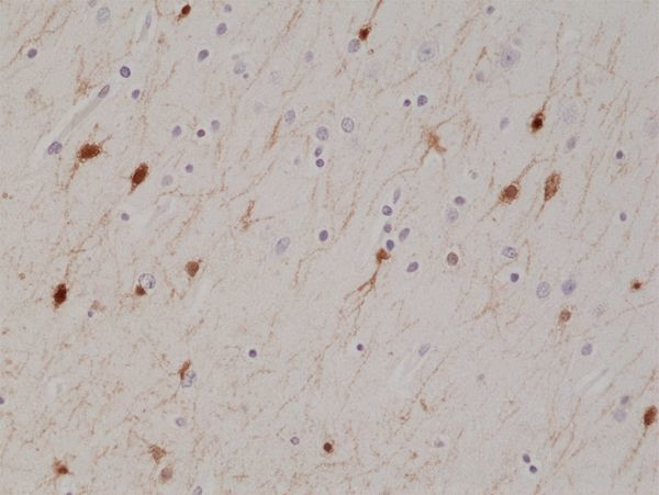 Calretinin Antibody in Immunohistochemistry (Paraffin) (IHC (P))