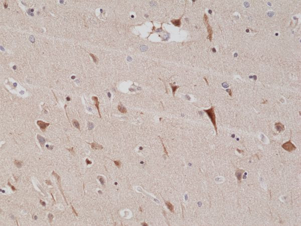 PSD-95 Antibody in Immunohistochemistry (Paraffin) (IHC (P))