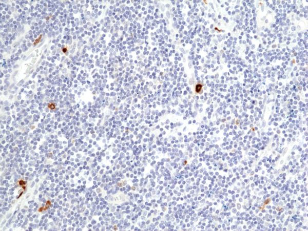 Granzyme B Antibody in Immunohistochemistry (Paraffin) (IHC (P))