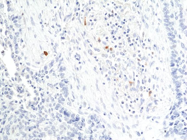 Granzyme B Antibody in Immunohistochemistry (Paraffin) (IHC (P))