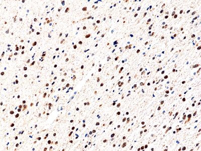 IDH1 (R132H) Antibody in Immunohistochemistry (Paraffin) (IHC (P))