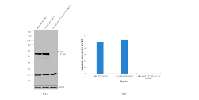 Cytokeratin 8 Antibody