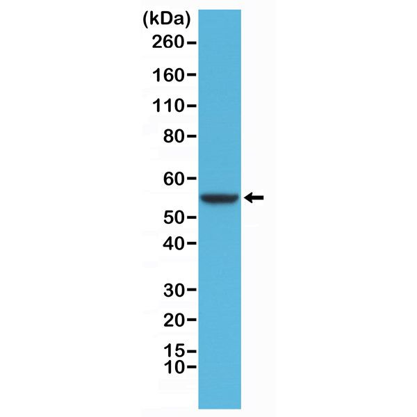 Cytokeratin 8 Antibody in Western Blot (WB)