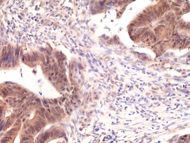 SMAD4 Antibody in Immunohistochemistry (Paraffin) (IHC (P))