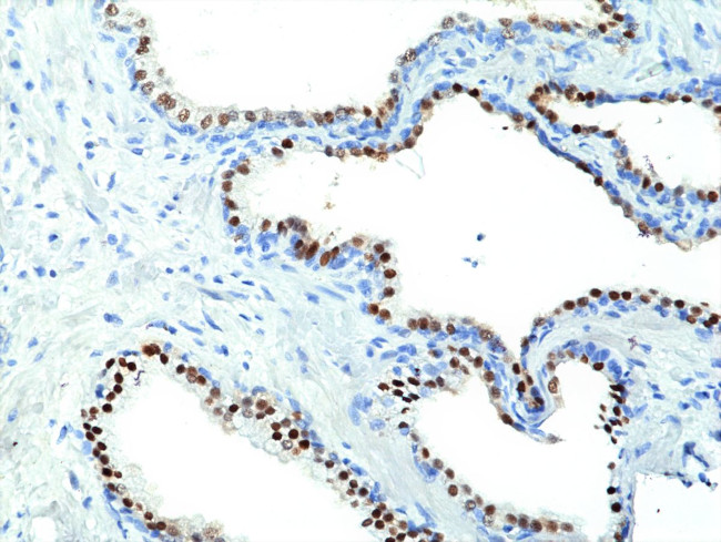 Nkx3.1 Antibody in Immunohistochemistry (Paraffin) (IHC (P))