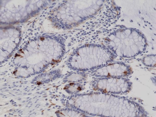 Synaptophysin Antibody in Immunohistochemistry (Paraffin) (IHC (P))